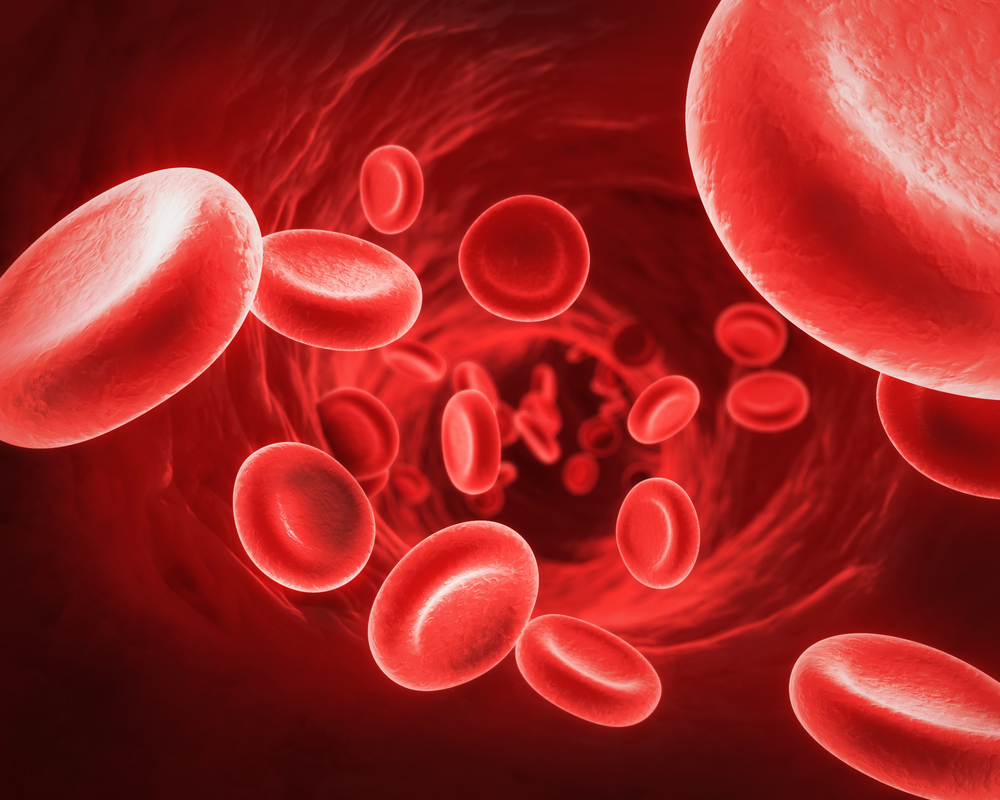 hemolytic anemia in sarcoidosis
