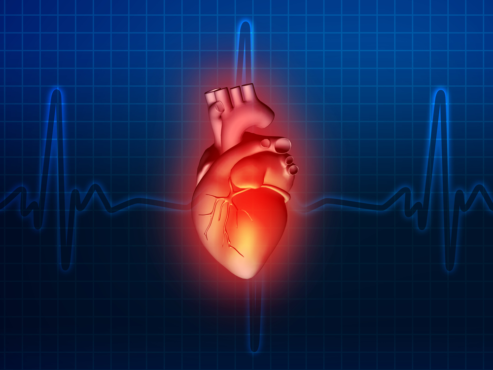 cardiac sarcoidosis risk factors