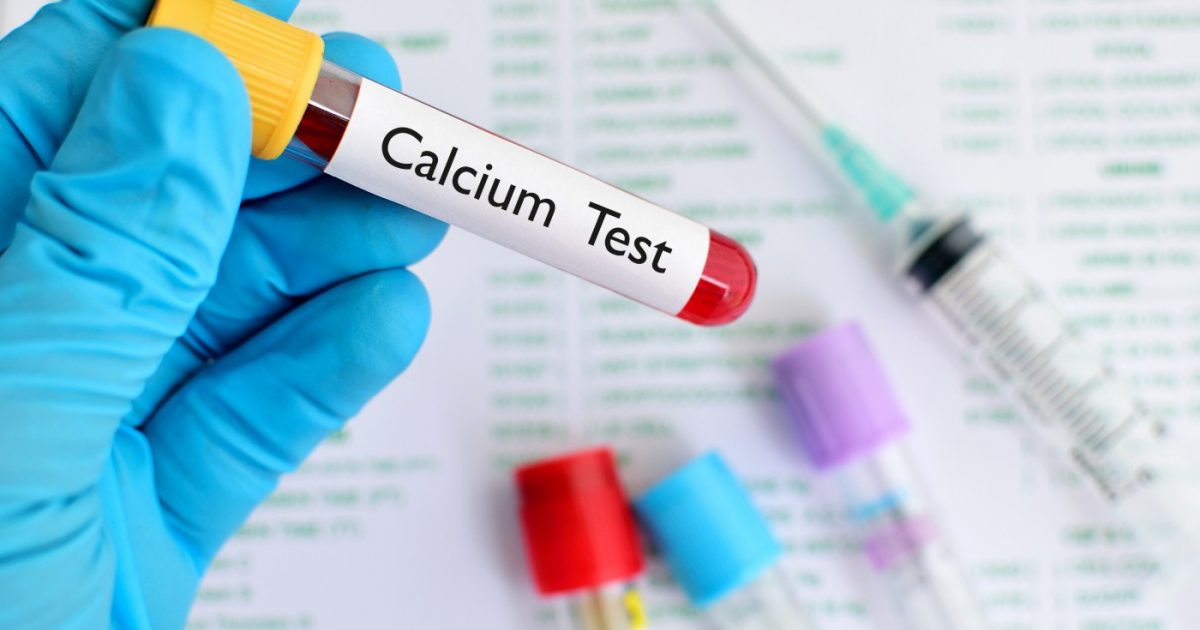 Vitamin D Supplements in Sarcoidosis Linked to Hypercalcemia Risk