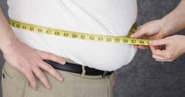 obesity, smoking and sarcoidosis