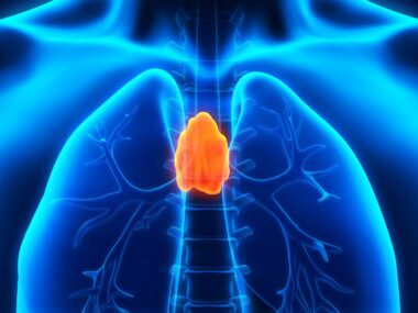thymus in sarcoidosis