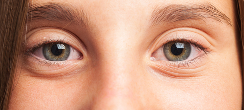 Ocular symptoms in sarcoidosis