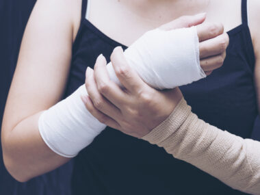 glucocorticoids and fractures