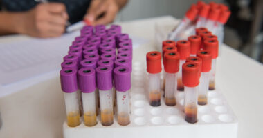 adiponectin blood levels