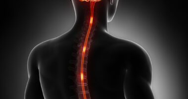 neurosarcoidosis study