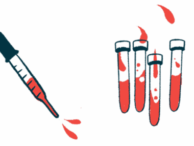 A dropper squirting blood is pictured alongside four half-filled vials.