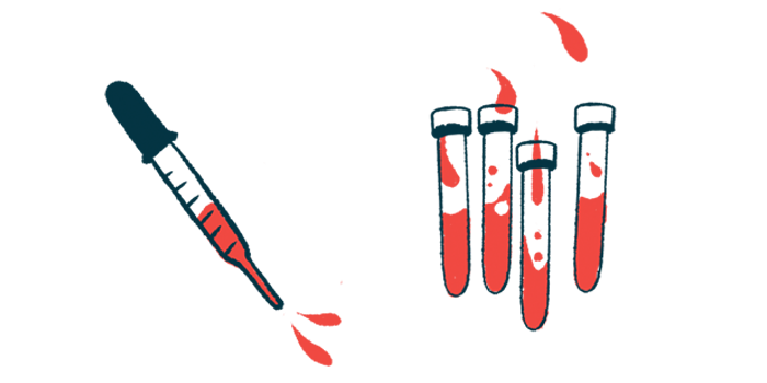 An illustration of vials of blood next to a dropper.