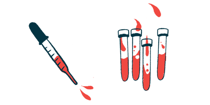 An illustration of vials of blood next to a dropper.