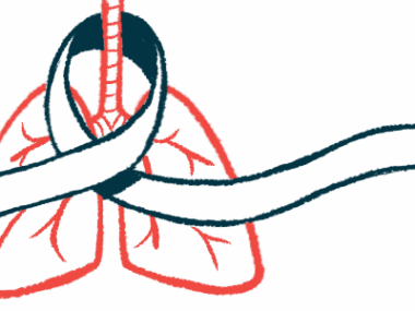 An illustration of an 