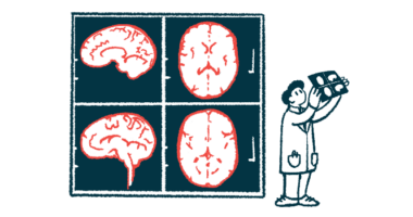 A medical professional looks at a brain scan.