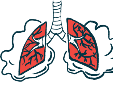 Illustration of human lungs showing inflamed and scarred lung tissue.